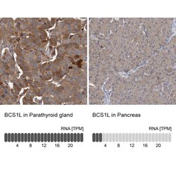 BCS1L Antibody, Novus Biologicals:Antibodies:Primary Antibodies